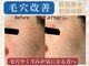 ハス(hasu.)の写真