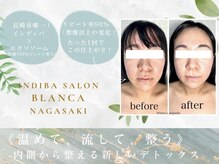 ブランカ ナガサキ(BLANCA NAGASAKI)