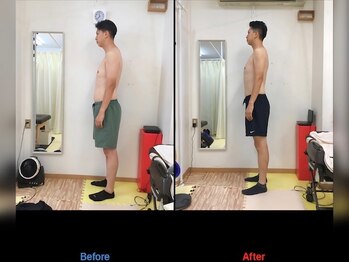 なぎ整体院/猫背矯正の変化です