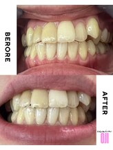 エクシアホワイトニング 王寺店/