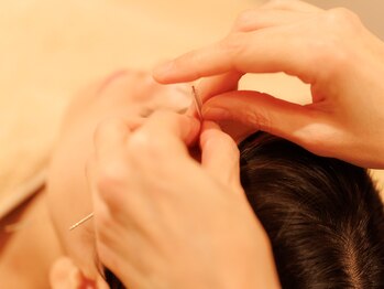 うずまきはり灸治療院/お顔のはり