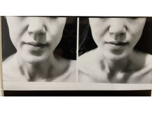 ダルセーニョ/お顔の歪み(ゆがみ)☆矯正骨気☆