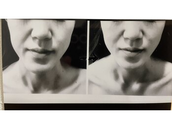 ダルセーニョ/お顔の歪み(ゆがみ)☆矯正骨気☆