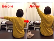 ゆかわ鍼灸整骨院/肩