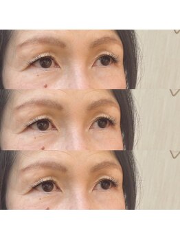 シアミス(SIAMIHS)/ボリュームラッシュ