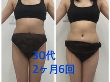 ラヴィアンローズ 岐阜本店(La vie en Rose)の雰囲気（3ヶ月集中痩身ダイエット《腹/二の腕/足/背中》）