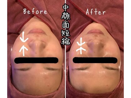 エステティックジュネス(JEUNESSE)の写真