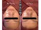 エステティックジュネス(JEUNESSE)の写真