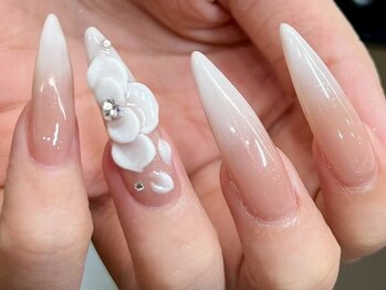 ネイルアンドアイラッシュスタジオ シュシュ(chouchou)の写真/短い、折れた、形が気になる…美フォルムとツヤのある仕上りに!【パラジェルスカルプ/深爪矯正/亀裂補強】