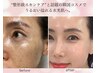 【おすすめ】たるみ・毛穴・くすみ改善◎韓国肌管理で透明感ある艶肌に♪
