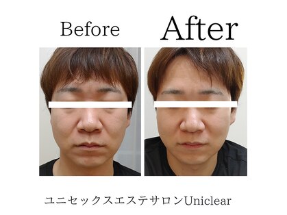 ユニクリア(Uni clear)の写真