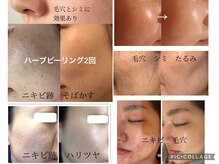 ジョリーフォアフローラ(Jolie for Flora)