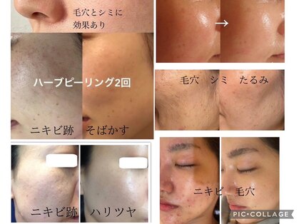 ジョリーフォアフローラ(Jolie for Flora)の写真