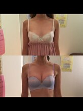 ヴィーナス(Venus)/バストアップ（痩身効果◎整体◎