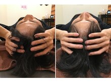 恵比寿西口整体院/頭の大きさの変化に驚き！