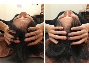 恵比寿西口整体院/頭の大きさの変化に驚き！