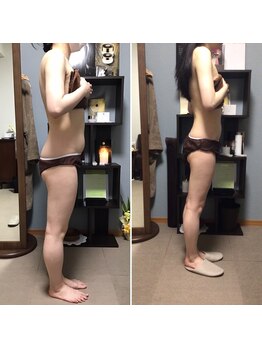 シェノンミュリール(Chainon Murir)/施術結果