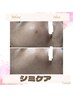 【初回お試し/メンズもOK】シミケア改善◇同時にお肌全体もキレイに◇￥9800