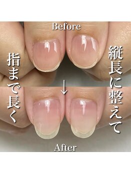 リリー/爪の面積が縦に伸びる☆☆☆