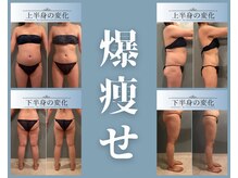 ボディエステティック アクアオーラ 高岡店