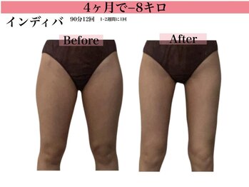 エステサロン ヴリエ 立川店/★ハイパーナイフ60分★12回結果