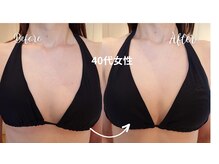 サロンハナ(Salon HANA)/痩せ型の方でもバストふっくら
