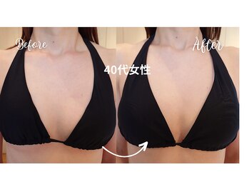 サロンハナ(Salon HANA)/痩せ型の方でもバストふっくら