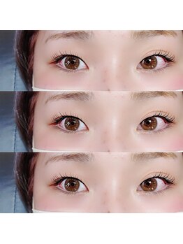 ラムール 姫路(L'AMOUR+)/一重から二重に?!