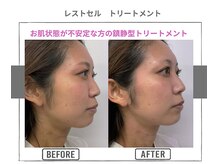 ラ ルーチェ 星田/レストセル　トリートメント