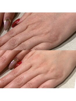 グロウハンドスパ