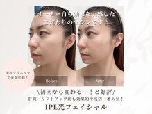 アリー 桜木町(Ary)