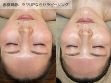 クレスト(CLEST.)/セラピール/直後からツヤツヤ