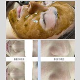 エルモア(L-MORE)