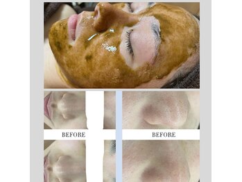 エルモア(L-MORE)