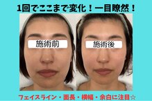 エムズサロン(m’sサロン)