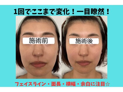 エムズサロン(m’sサロン)の写真