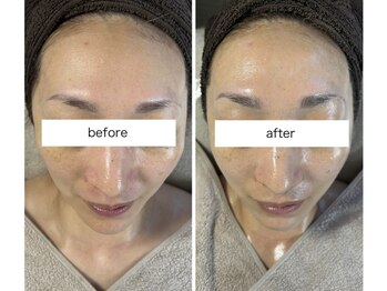 リボン(Ribbon)/延髄スプレーラグジュアリー