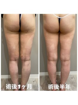 サロンシファ(salon sifa)/術後ケア