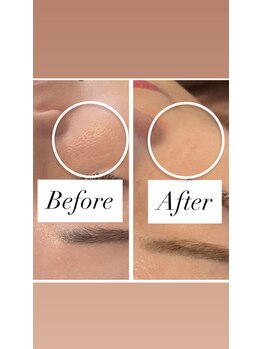 ナルシス(Narcissus)/選べるハイドロジェリーパック