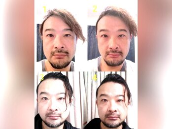 整体院 てんとてん 吉祥寺/小顔の変化