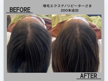 ネムリビト/少しづつ地肌を隠していく