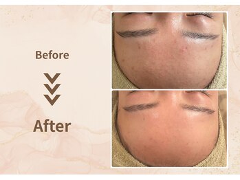 プラム(plum)/セルマン