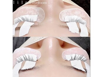 ライラック(lilac)/ラッシュアディクト