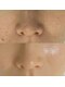 スーメ 柏(soome')の写真/韓国式の肌管理で、つるんとした陶器肌へ。毛穴の汚れをすっきり落として透明感UP＊[柏/フェイシャル]