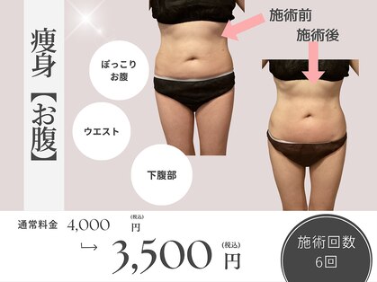 サロン ド ミコ(Salon de Mico)の写真