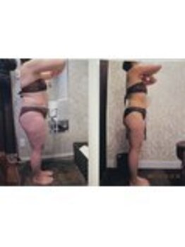 パーフェクトボディプレミアム 渋谷店(PERFECT BODY PREMIUM)/お客様 ビフォーアフター(15)