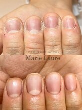 マリーロール 淀屋橋本店(Marie Laure)/自爪育成/深爪矯正/ネイルケア
