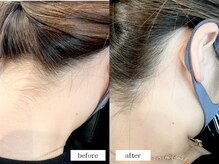 エムドット(m.)/うなじワックス脱毛