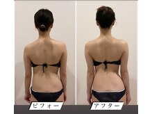 TMサロン 赤坂/首肩＆美姿勢＆骨盤を同時ケア