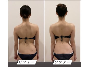 TMサロン 赤坂/首肩＆美姿勢＆骨盤を同時ケア